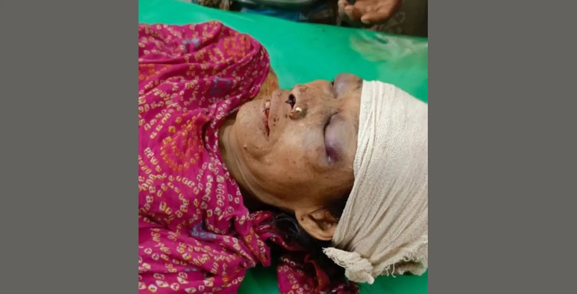 বাউফলে জমি সংক্রান্ত বিরোধকে কেন্দ্র করে হামলায় নারীর মৃত্যু 