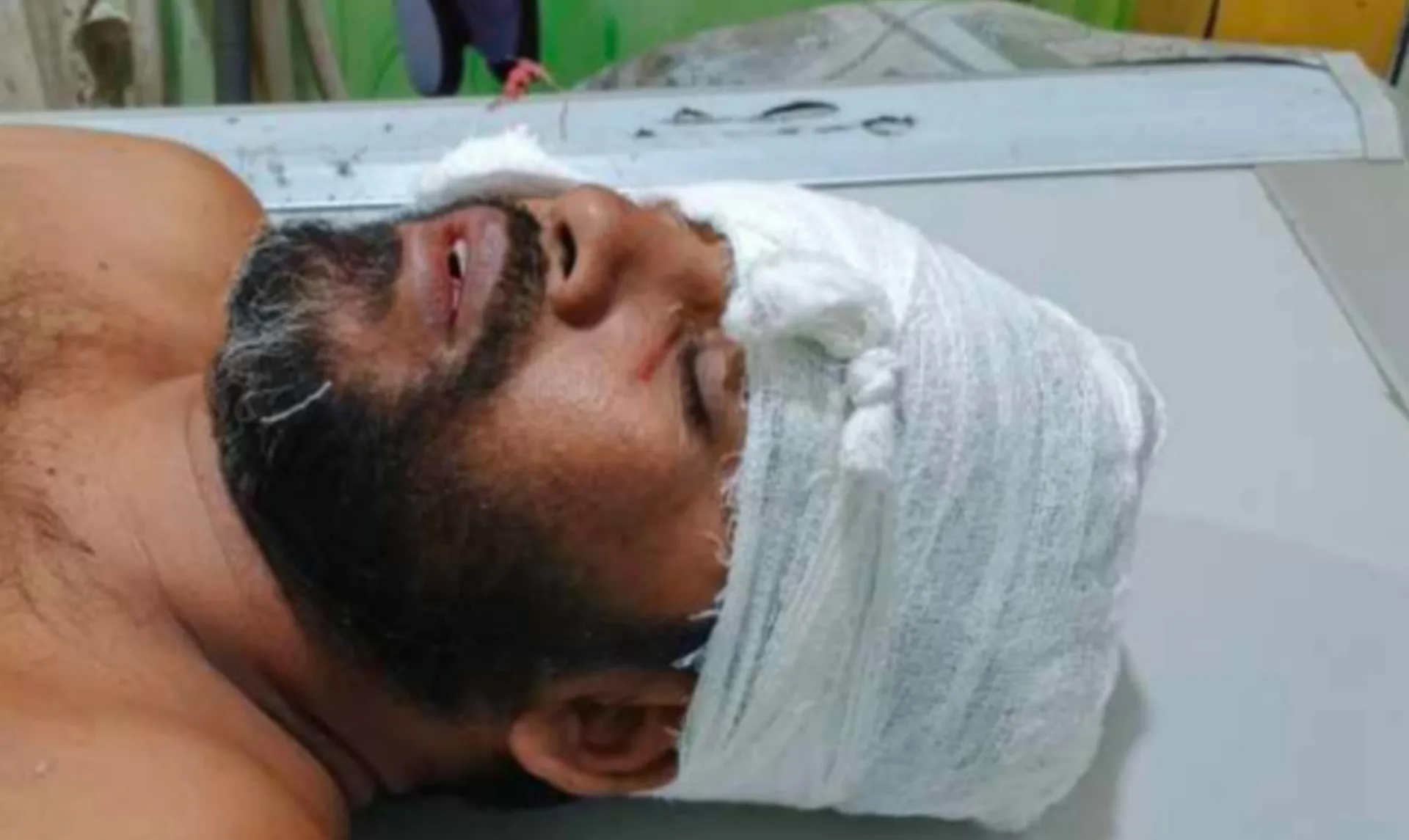 সংবাদ প্রকাশের জেরে সাংবাদিককে কুপিয়ে জখম, অবস্থা আশঙ্কাজনক