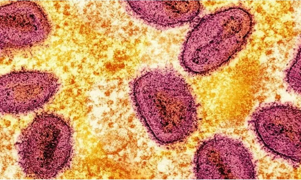 আফ্রিকায় নতুন ভাইরাস মারবুর্গের প্রাদুর্ভাব, আক্রান্ত ৯