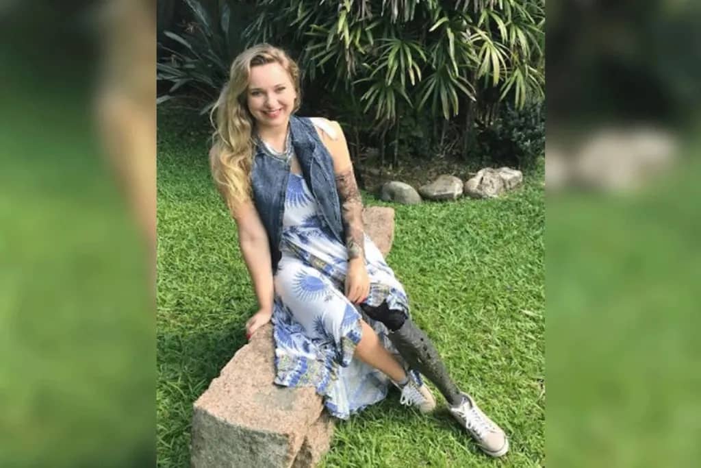 রেলের চাকায় হাত-পা হারানো তরুণী পাচ্ছেন ৮২ মিলিয়ন ডলার