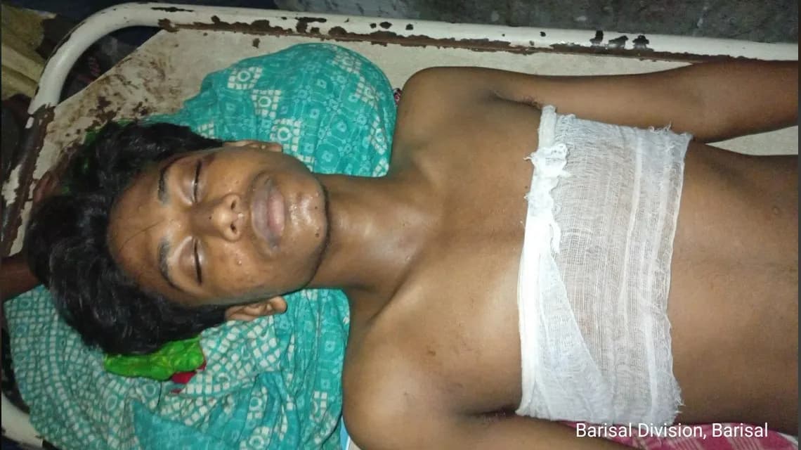 আমতলীতে ছাত্রদলের সদস্য সচিব ইমরানের নেতৃত্বে দুই কিশোরকে কুপিয়ে জখম