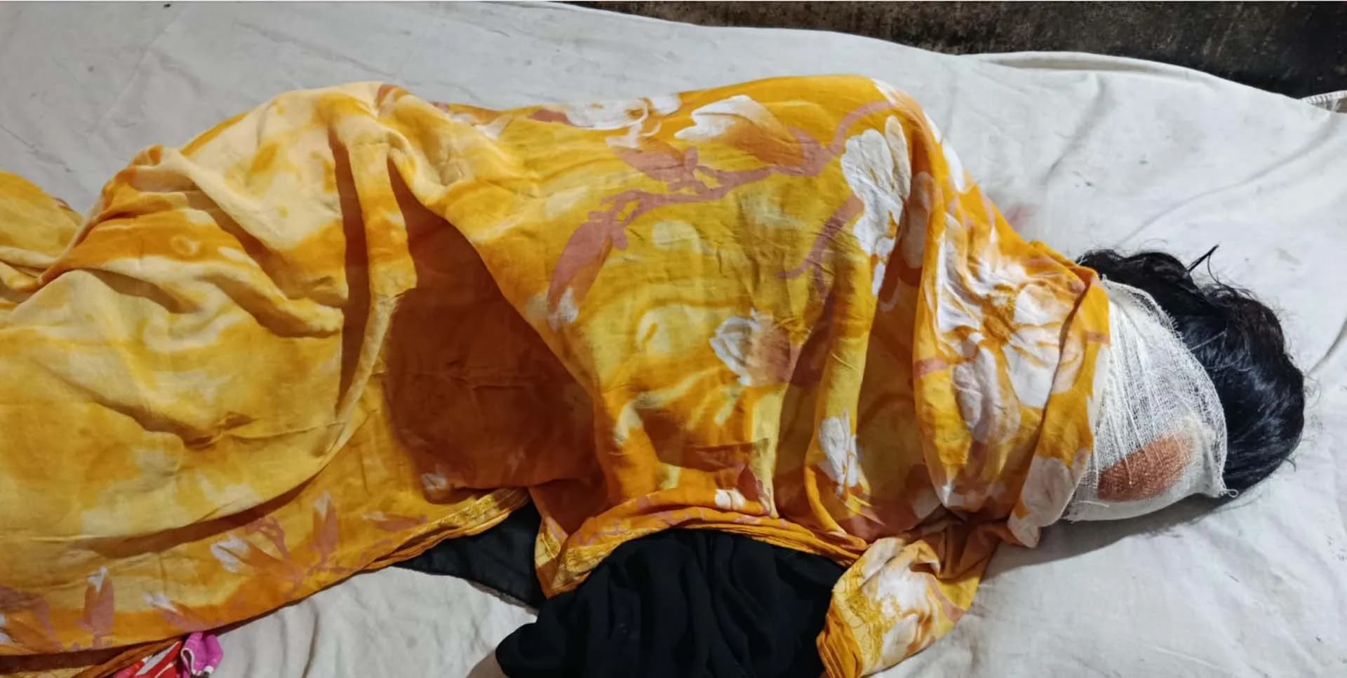 জমি সংক্রান্ত বিরোধে মারামারি,কলেজ ছাত্রী আহত